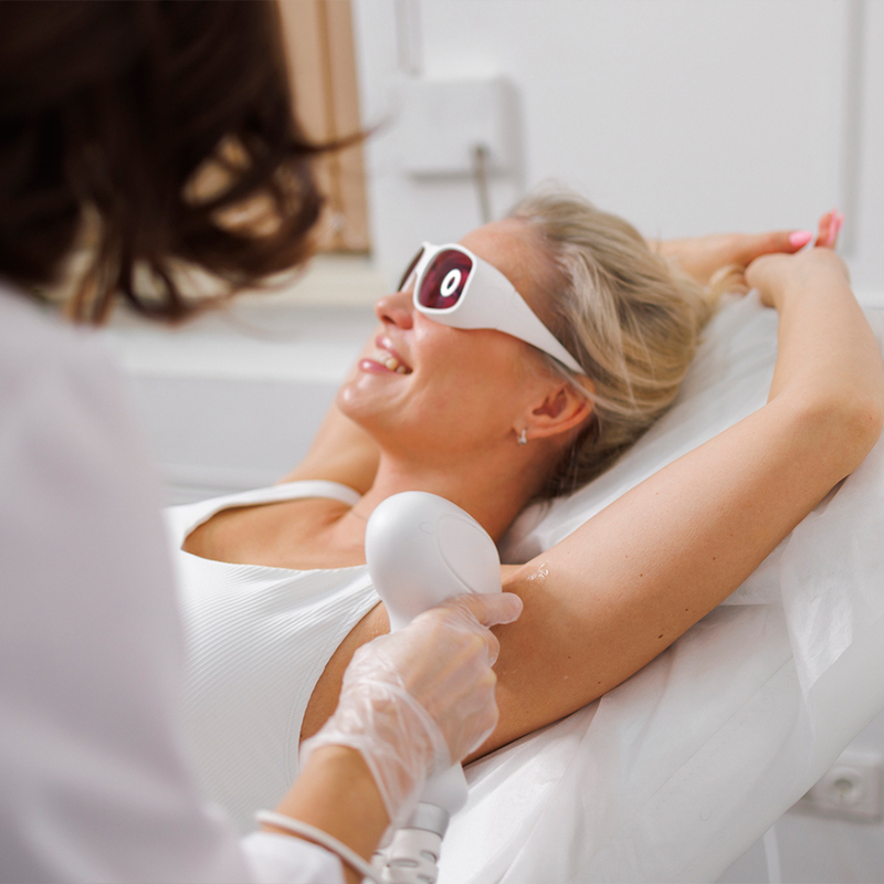 Woman receiving laser hair removal underarm treatment at a clinic.