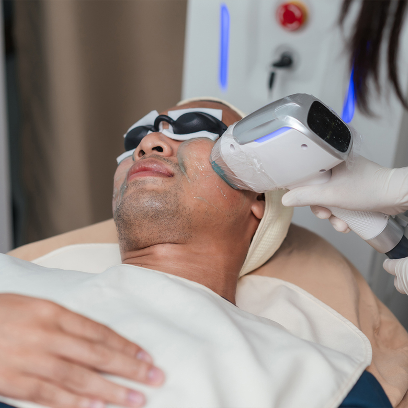 Man receiving laser skin treatment with protective goggles.