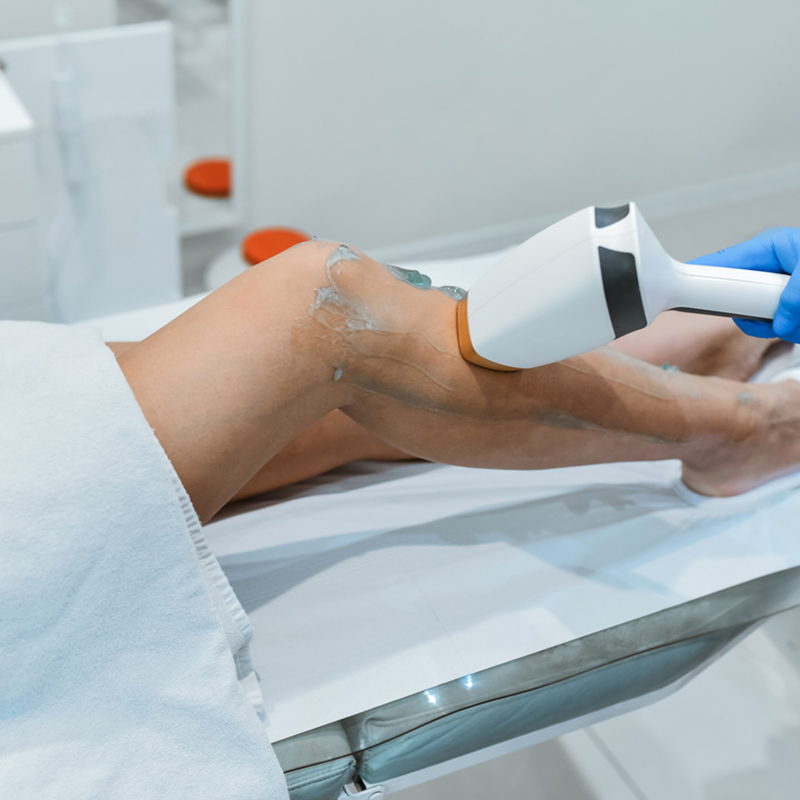 Laser hair removal treatment on a person's leg in a clinic setting.