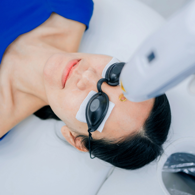 A woman receiving a laser treatment with protective eyewear in a clinic.