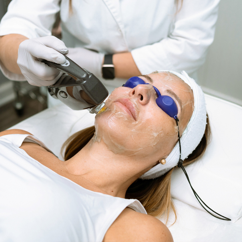Facial laser treatment on a woman wearing protective goggles in a spa setting.